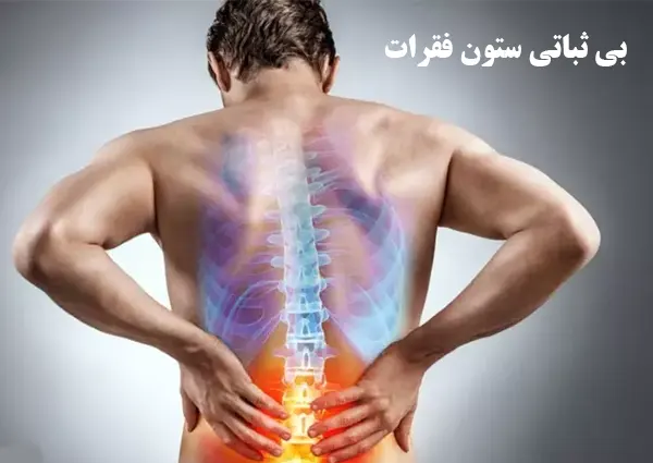 بی ثباتی ستون فقرات