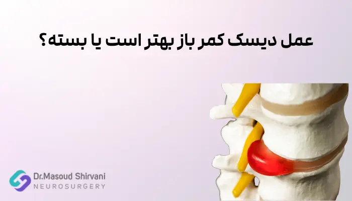 عمل دیسک کمر باز بهتر است یا بسته؟ عمل دیسک کمر باز بهتر است یا بسته؟