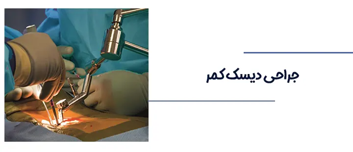 عمل دیسک کمر