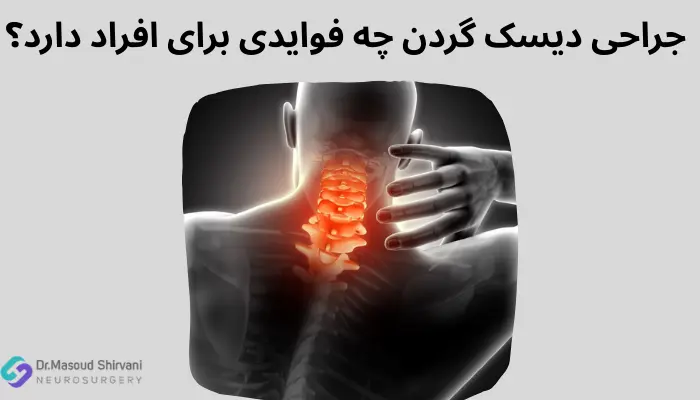 جراحی دیسک گردن چه فوایدی برای افراد دارد؟