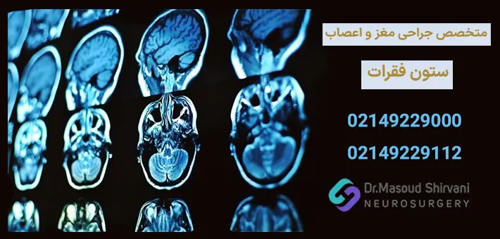 جراح مغز و اعصاب تهران