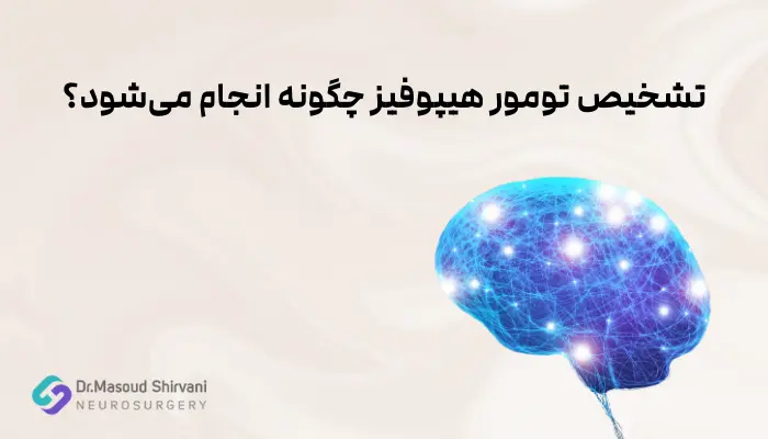 تشخیص تومور هیپوفیز چگونه انجام میشود؟