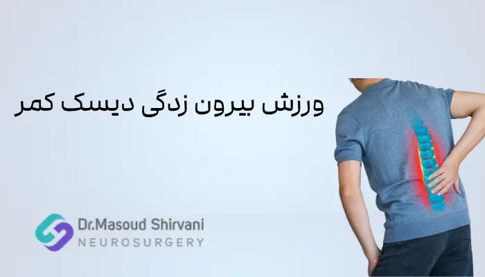 ورزش های مناسب بیرون زدگی دیسک کمر