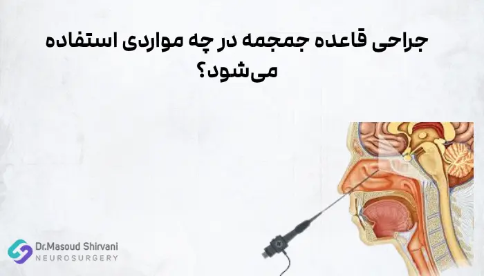جراحی قاعده جمجمه در چه مواردی استفاده میشود؟