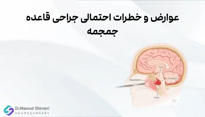عوارض و خطرات احتمالی جراحی قاعده جمجمه