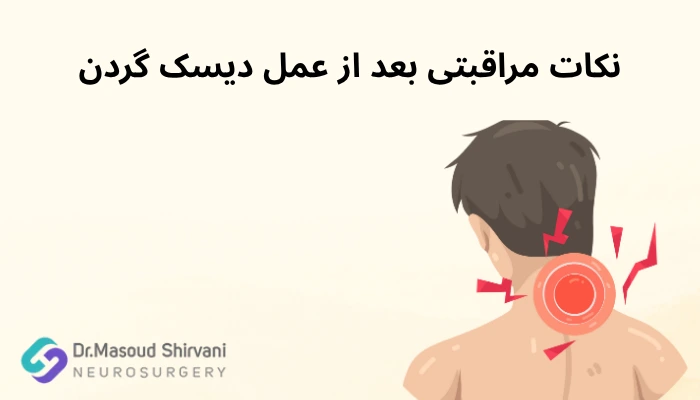 نکات مراقبتی بعد از عمل دیسک گردن نکات مراقبتی بعد از عمل دیسک گردن