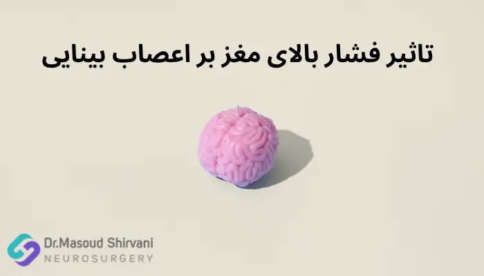 تاثیر فشار بالای مغز بر اعصاب بینایی