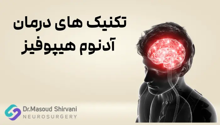 تکنیک های درمان آدنوم هیپوفیز