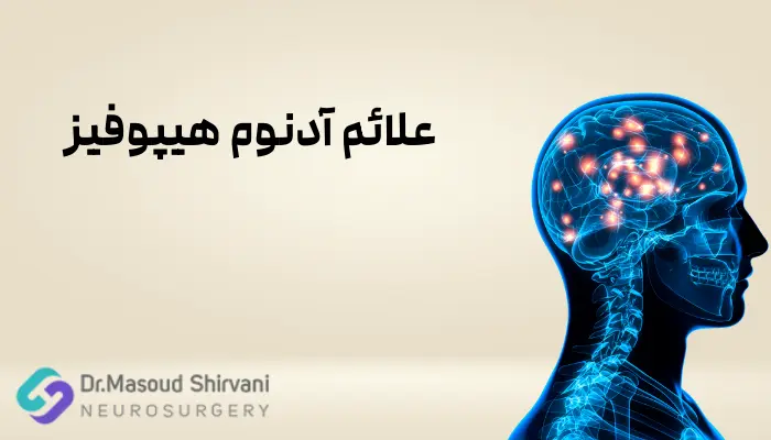 علائم آدنوم هیپوفیز