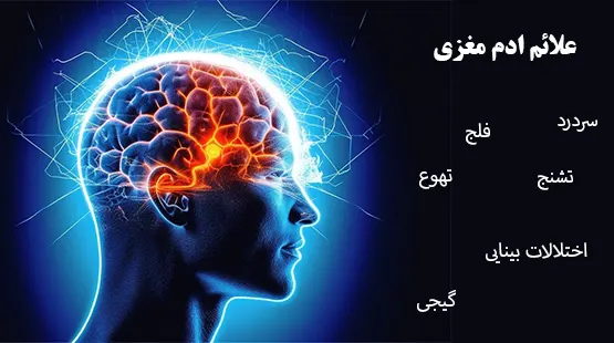 علائم ادم مغزی