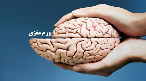 ورم مغزی