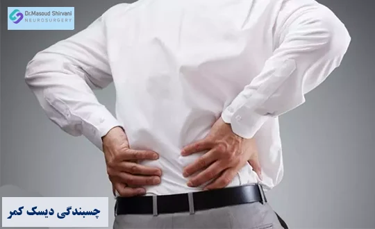 چسبندگی دیسک کمر