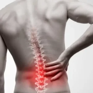 سندروم دم اسبی