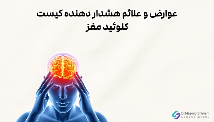 عوارض و علائم هشدار دهنده کیست کلوئید مغز