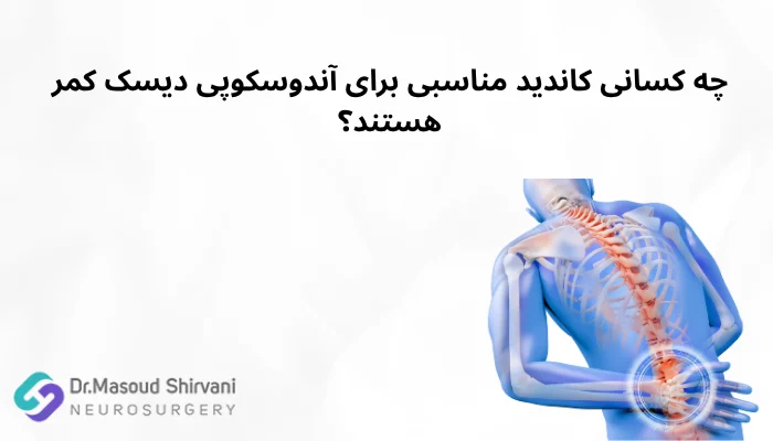 چه کسانی کاندید مناسبی برای آندوسکوپی دیسک کمر هستند؟ چه کسانی کاندید مناسبی برای آندوسکوپی دیسک کمر هستند؟