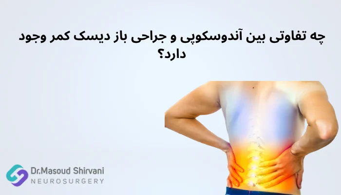 چه تفاوتی بین آندوسکوپی و جراحی باز دیسک کمر وجود دارد؟ چه تفاوتی بین آندوسکوپی و جراحی باز دیسک کمر وجود دارد؟