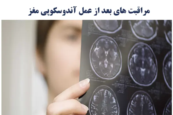 مراقبت های بعد از عمل آندوسکوپی مغز
