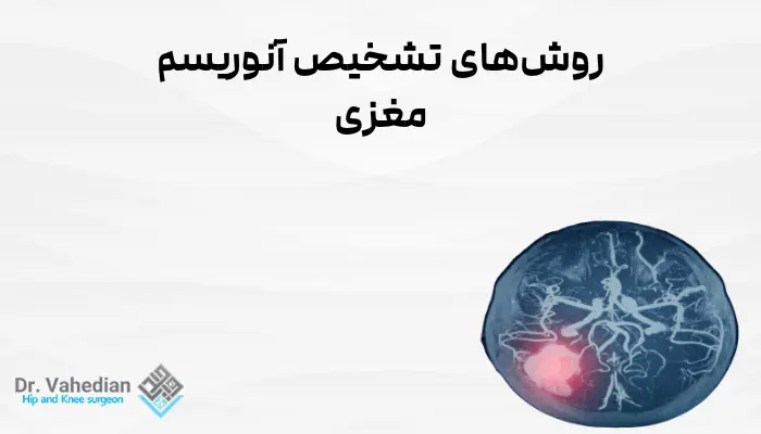 روشهای تشخیص آنوریسم مغزی
