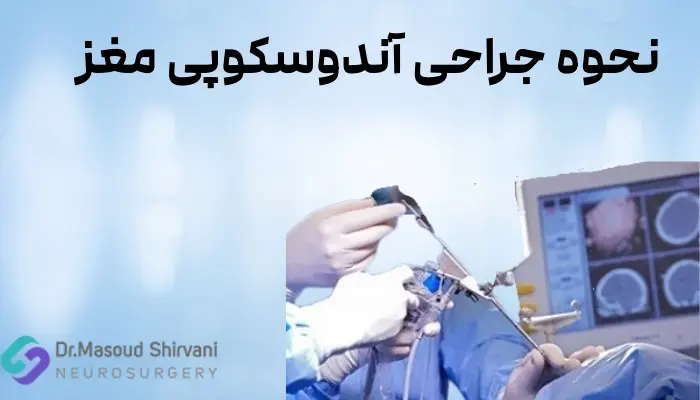 نحوه جراحی آندوسکوپی مغز