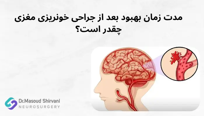 مدت زمان بهبود بعد از جراحی خونریزی مغزی چقدر است؟ مدت زمان بهبود بعد از جراحی خونریزی مغزی چقدر است؟