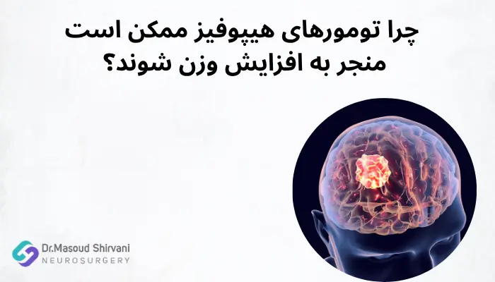 چرا تومورهای هیپوفیز ممکن است منجر به افزایش وزن شوند؟ چرا تومورهای هیپوفیز ممکن است منجر به افزایش وزن شوند؟