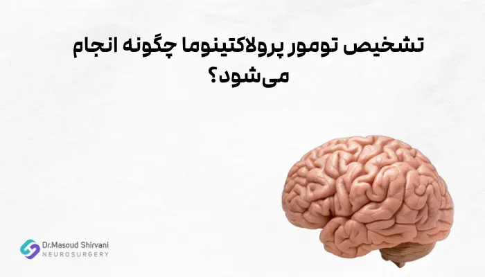 تشخیص تومور پرولاکتینوما چگونه انجام میشود؟