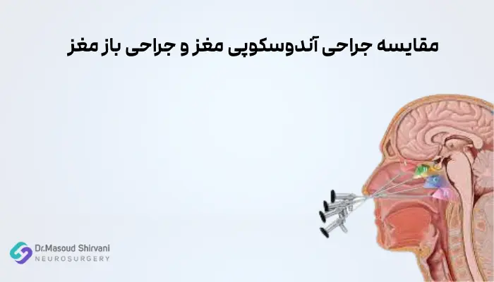 مقایسه جراحی آندوسکوپی مغز و جراحی باز مغز